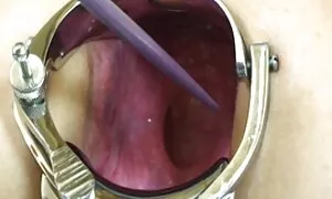 طالب 2-pc 5-B. مقاطع سكس ي تايلر